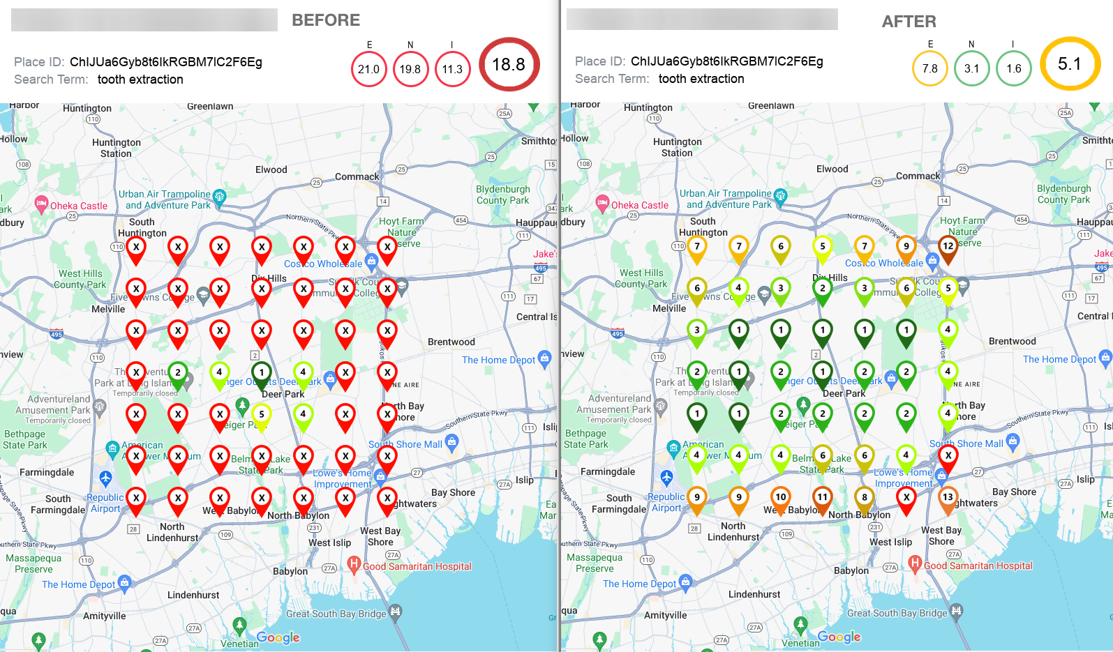 tooth extraction new tooth extraction new